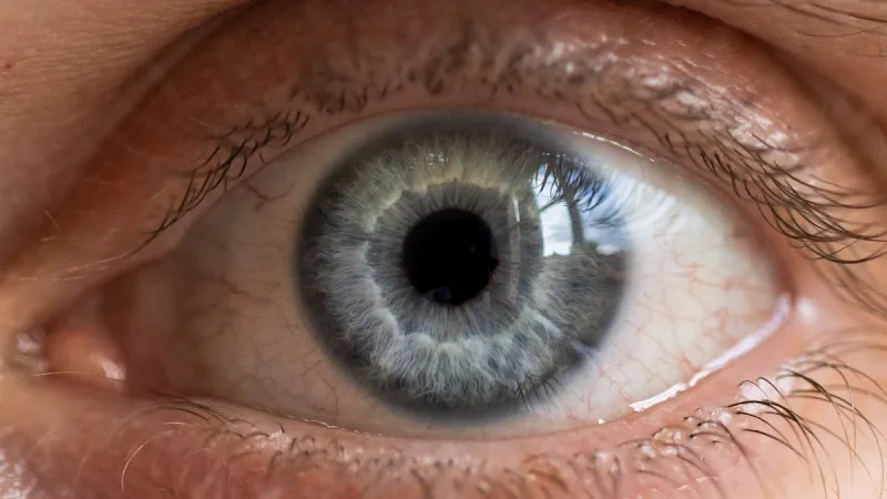 Macular Degeneration Diagnosis & Treatment