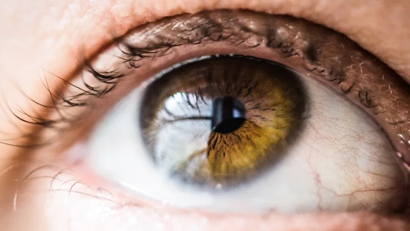 Pterygium & Pinguecula Removal