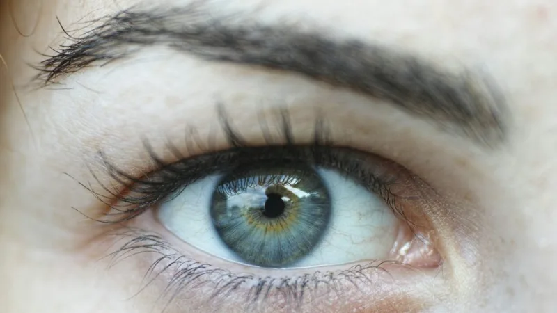 Upper Lid Blepharoplasty